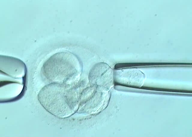 New Delhi, Health, Discover Assisted Embryo Hatching In Delhi At Fertylity IVF