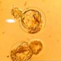 Blastocyst Transfer In Delhi With Personalized IVF Guidance | Fertylity IVF