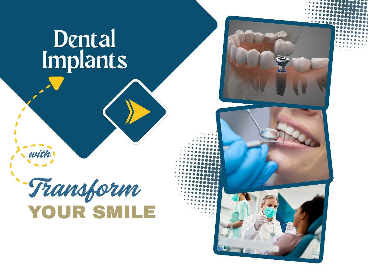 London, Health, Grab Offers And Deals On Tooth Implants Solution