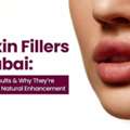 Aliaxin Fillers In Dubai: Enhance Your Natural Facial Features