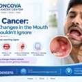 Oral Cancer: Early Changes In The Mouth You Shouldn&rsquo;t Ignore.