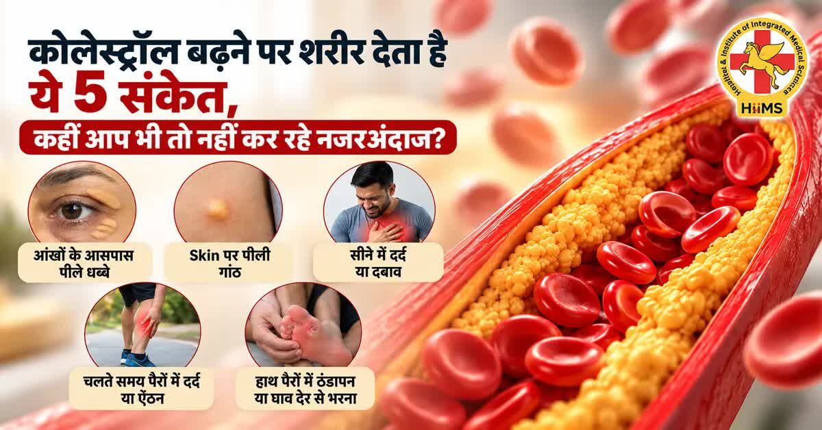 Mumbai, Health, Cholesterol Badhne Par Body Deti Hai Ye 5 Signs, Kahin Aap Bhi To Nahi Kar Rahe Nazarandaa