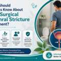Urethral Stricture Treatment Without Surgery: Understanding Your Options