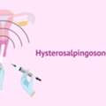 Hysterosalpingography In Delhi | Fertylity IVF Fertility Experts