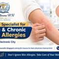 Trusted Specialist For Acute & Chronic Skin Allergies &ndash; Dr. Mouna HN
