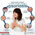Psoriasis Signs And Management- Dermacure - Rajahmundry