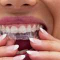 How Invisible Braces In Borivali Help Correct Misaligned Teeth