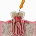 Trusted Cosmetic Dentistry In New York From Experienced Brooklyn Dental Experts