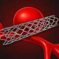 Exploring Coiling Aneurysm Procedure For Better Care?