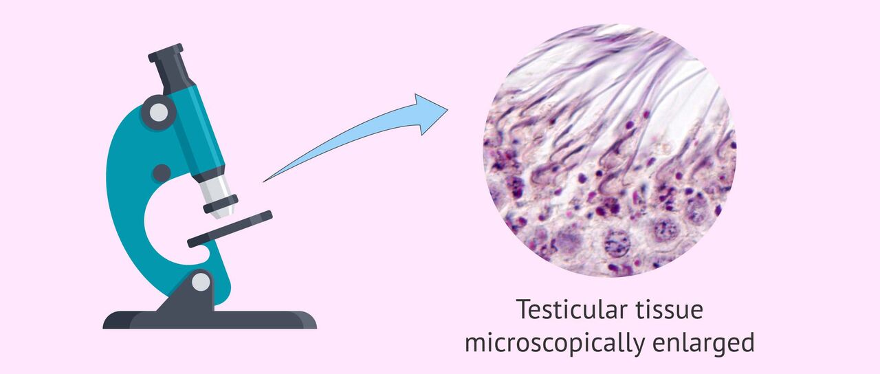 New Delhi, Health, Sperm/Testicular/Tissue In Delhi | Fertylity IVF Experts