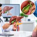 Find An Experienced Surgeon For Gallbladder Removal