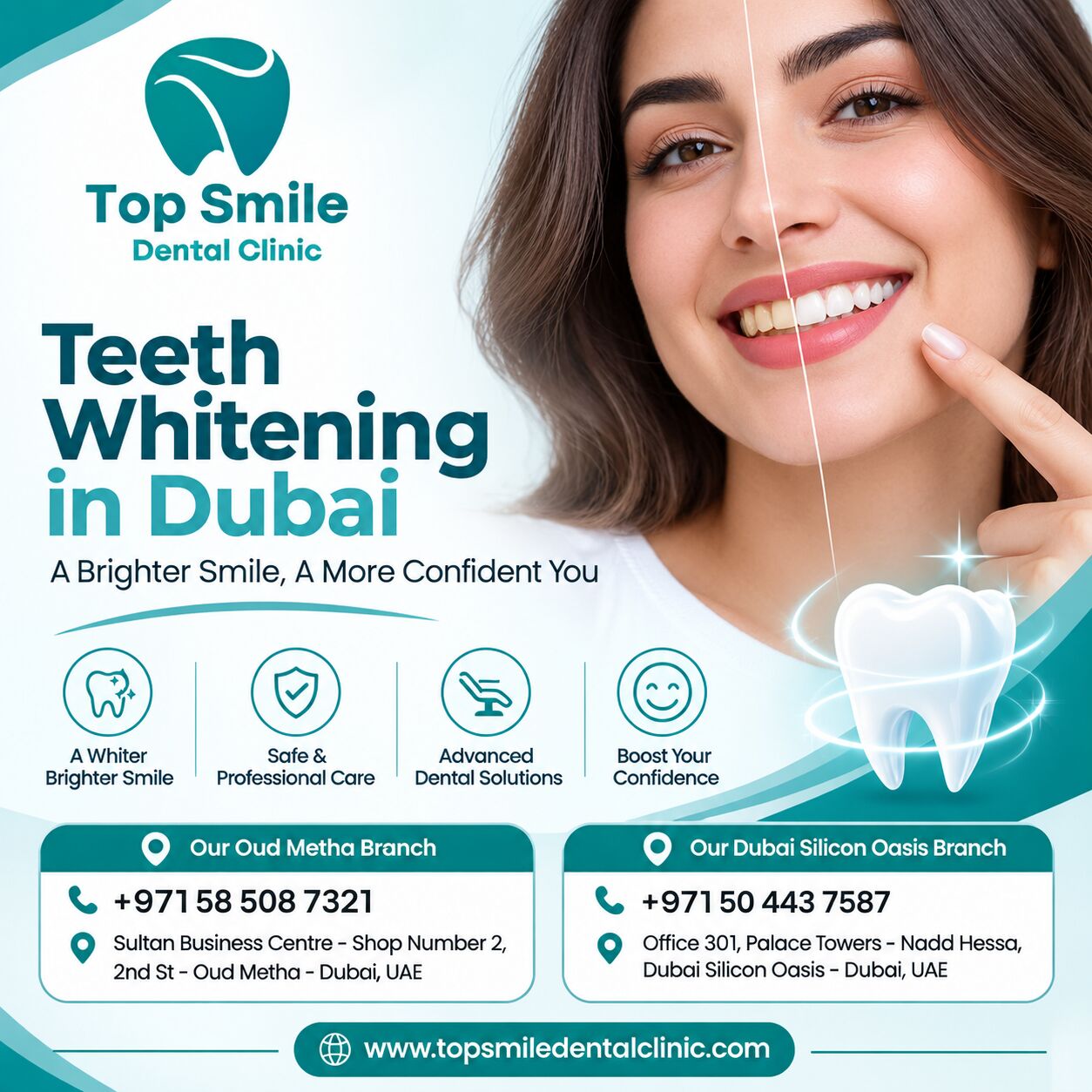 Dubai, Dental, Teeth Whitening In Dubai | Top Smile Dental Clinic