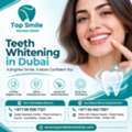 Teeth Whitening In Dubai | Top Smile Dental Clinic