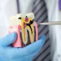 Root Canal Treatment In Madurai