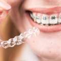 Best Invisalign Dentist In Madurai