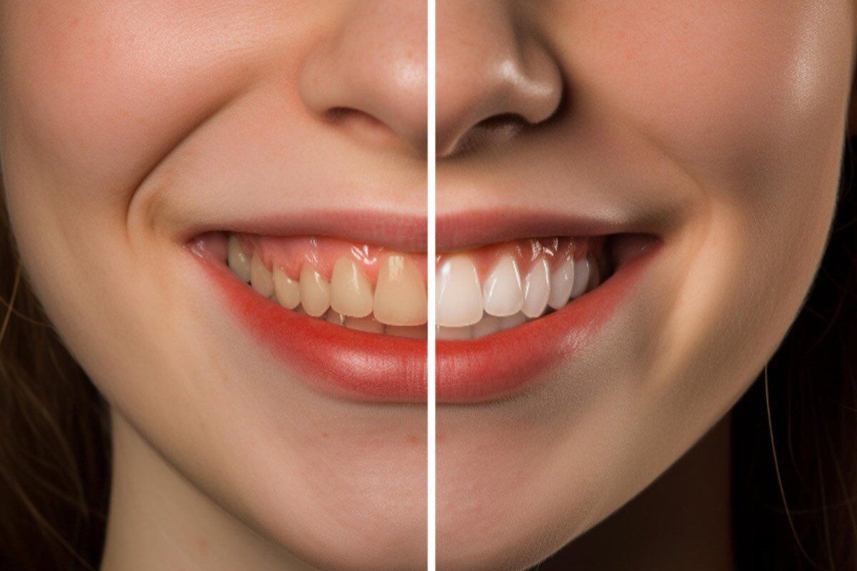 Madurai, Dental, Cosmetic Dentist In Madurai