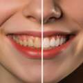 Cosmetic Dentist In Madurai