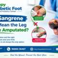 Does Gangrene Always Mean The Leg Has To Be Amputated? - Dr Uday Ravi