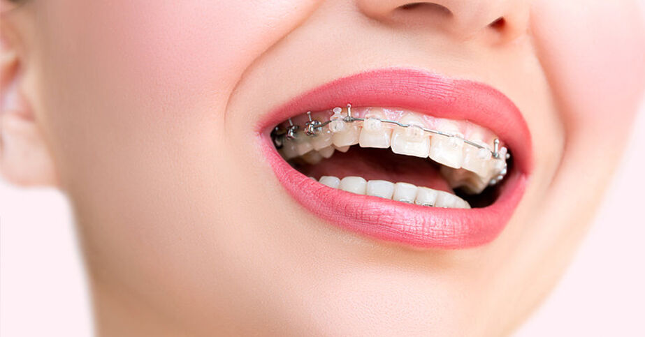 New Delhi, Dental, Best Dental Clinic In Delhi