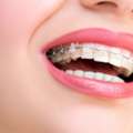 Best Dental Clinic In Delhi
