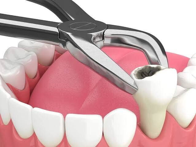 New York, Dental, General Dental Care For Healthy Teeth In Hudson Florida