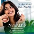 Invisalign Treatment In Vijayawada | Asian Dental