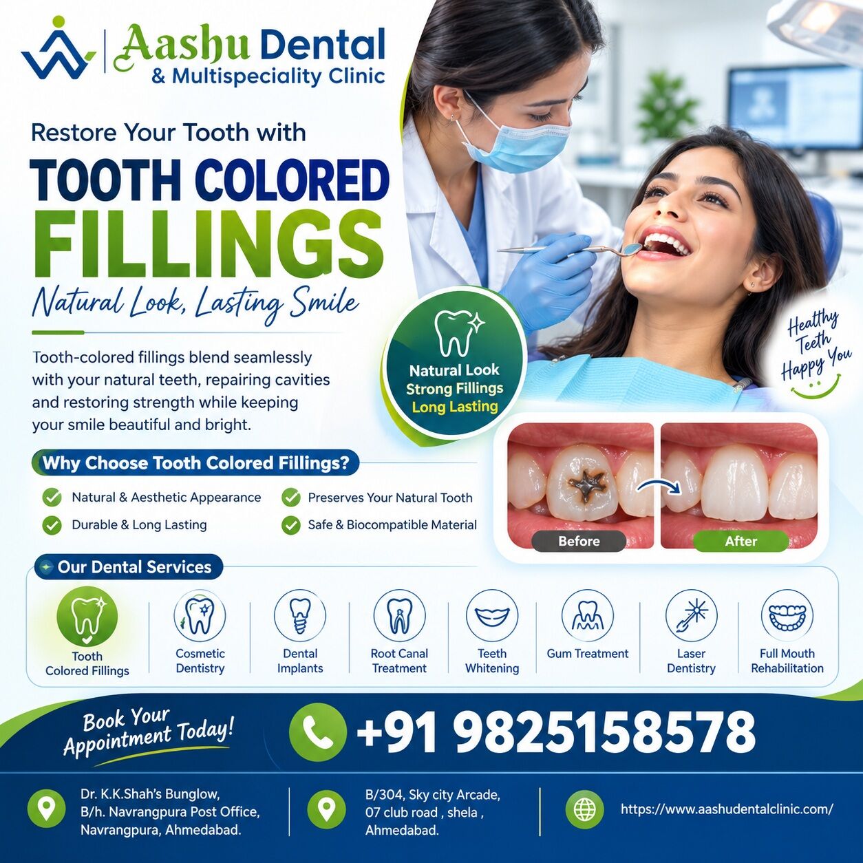 Ahmedabad, Dental, Restore Damaged Teeth With Tooth Colored Fillings In Ahmadabad