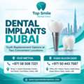 Dental Implants Dubai &ndash; Explore Tooth Replacement Options At Top Smile Dental Clinic