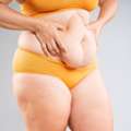 Tummy Tuck Surgery In Delhi - Dr Rajat Gupta