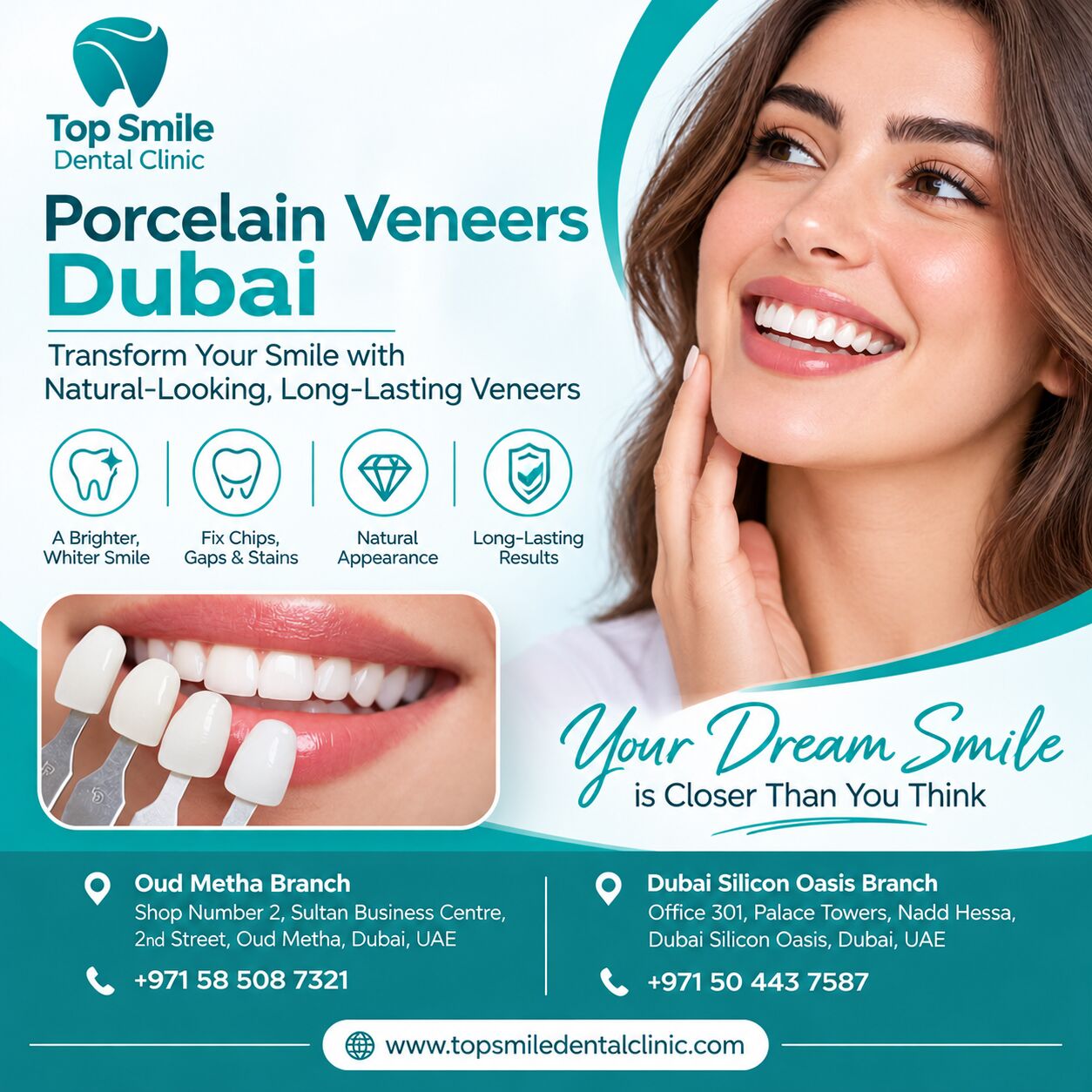 Dubai, Dental, Porcelain Veneers Dubai &ndash; Enhance Your Smile With Top Smile Dental Clinic