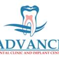 Best Root Canal Dentist In Maninagar, Ahmedabad | ADVANCE Dental Clinic
