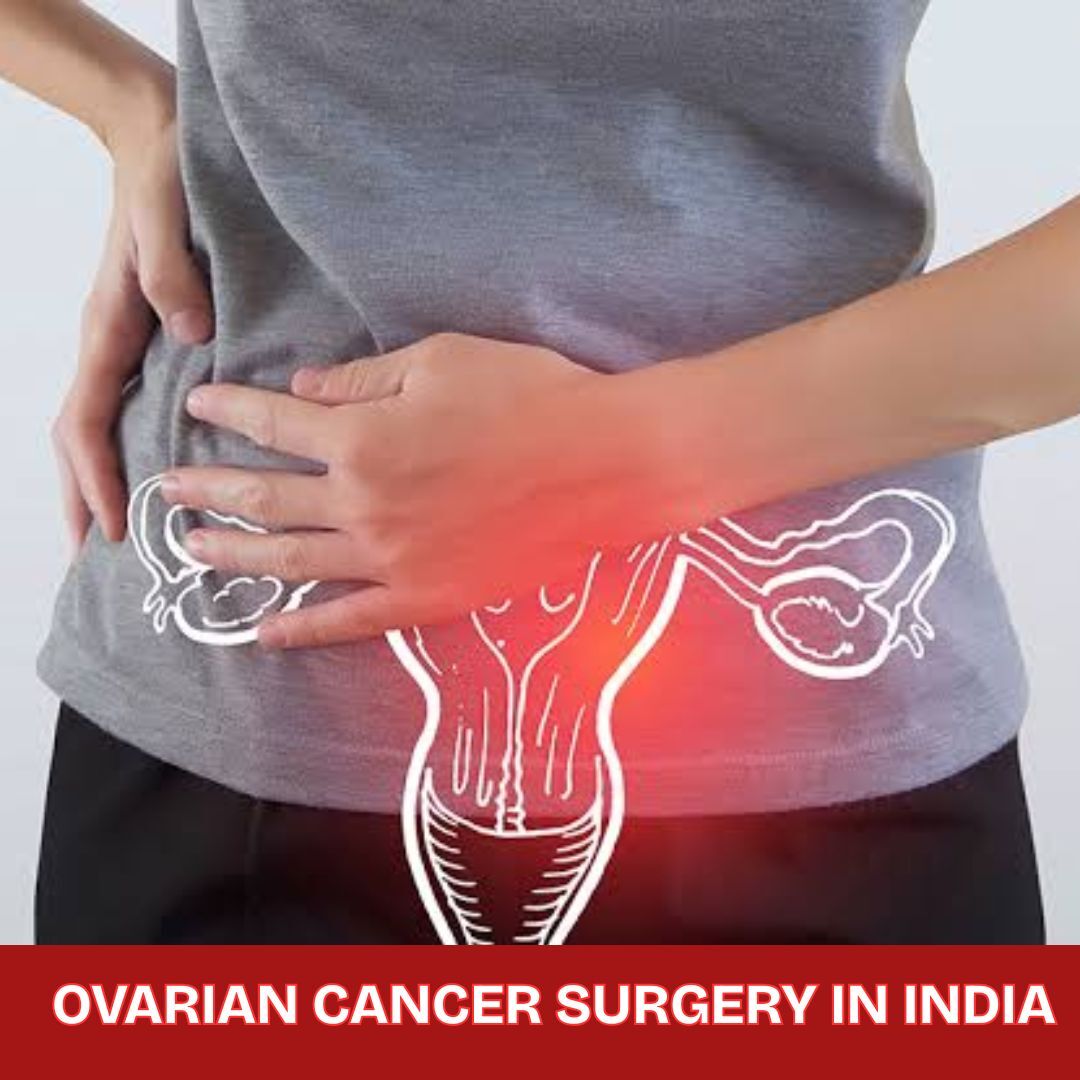 Mumbai, Health, Ovarian Cancer Surgery In India