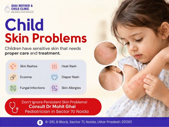 Noida, Health & Beauty Items, Child Skin Problems? Consult A Pediatrician In Sector 70 Noida