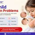 Child Skin Problems? Consult A Pediatrician In Sector 70 Noida
