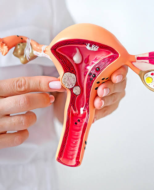 New Delhi, Health, Uterine Fibroids Treatment In Delhi