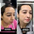 Best Skin Doctor In Delhi
