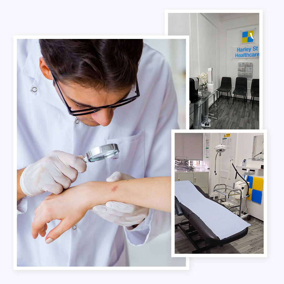 London, Health, Face Spot Treatment For Clearer, Healthier And More Even-Looking Skin
