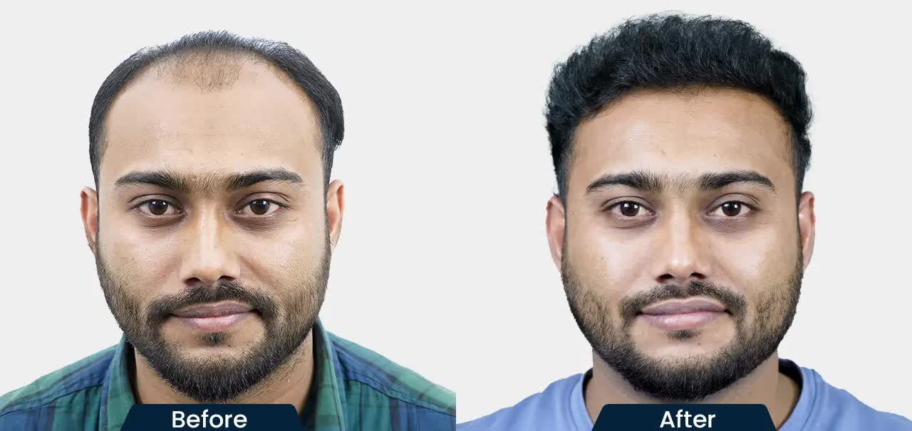 Mumbai, Health, HairFree And HairGrow Clinic