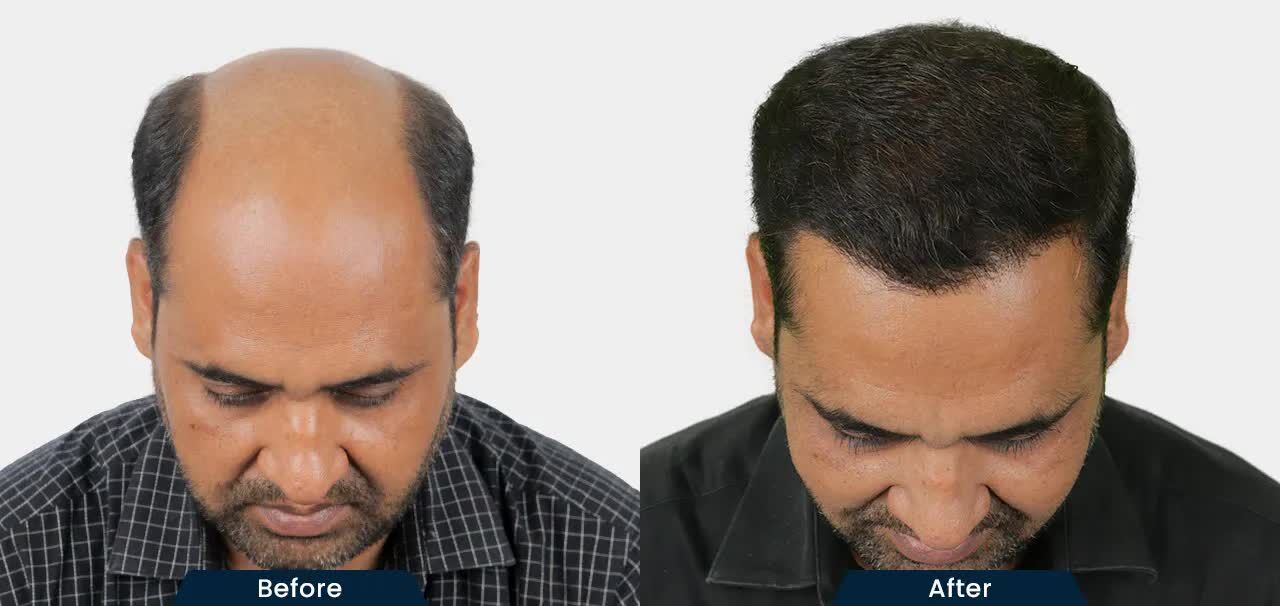 Mumbai, Health, HairFree And HairGrow Clinic