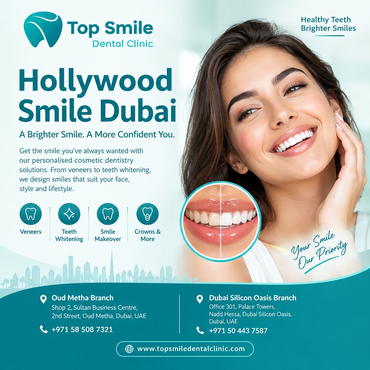Dubai, Dental, Hollywood Smile Dubai | Top Smile Dental Clinic