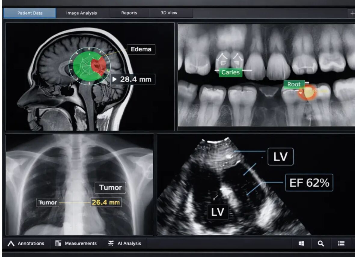 Ahmedabad, Technical, Medical Data Annotation Services In India - Pixel Annotation