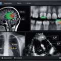 Medical Data Annotation Services In India - Pixel Annotation