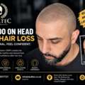 Hair Tattoo London | Natural-Looking SMP For Men &ndash; Skulltec
