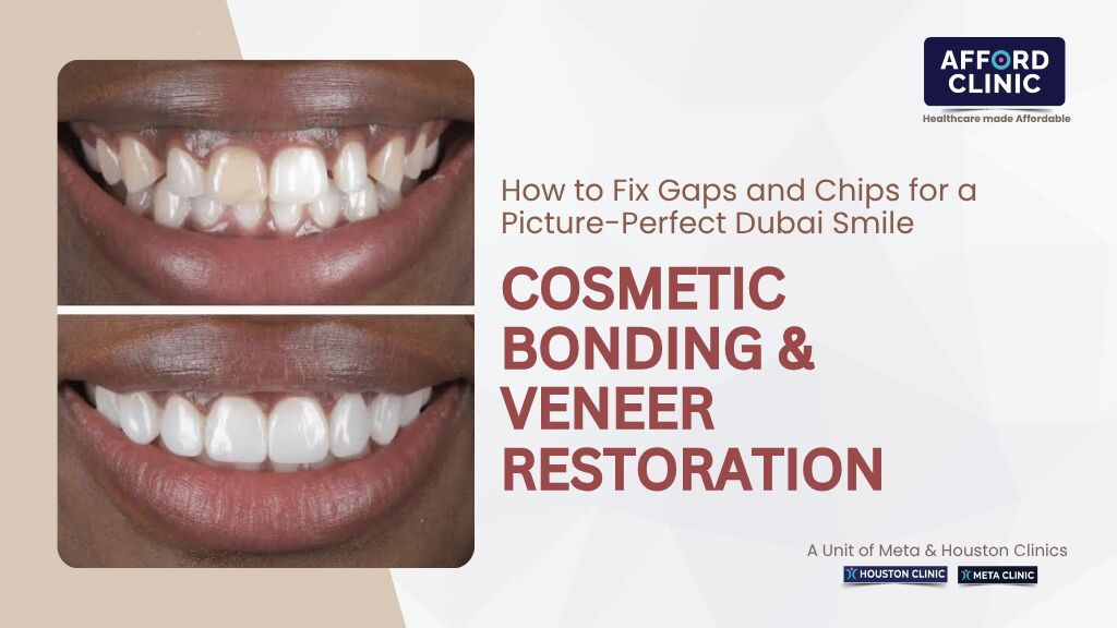 Al Nahda, Dental, How To Fix Gaps And Chips For A Picture-Perfect Dubai Smile &mdash; AFFORD Clinic In Al Nahda