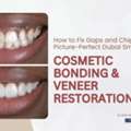 How To Fix Gaps And Chips For A Picture-Perfect Dubai Smile &mdash; AFFORD Clinic In Al Nahda