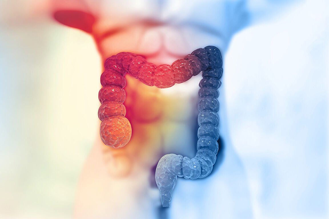 Ghaziabad, Health, Colon Cancer Care & Treatment In Noida | Dr. Manish Singhal