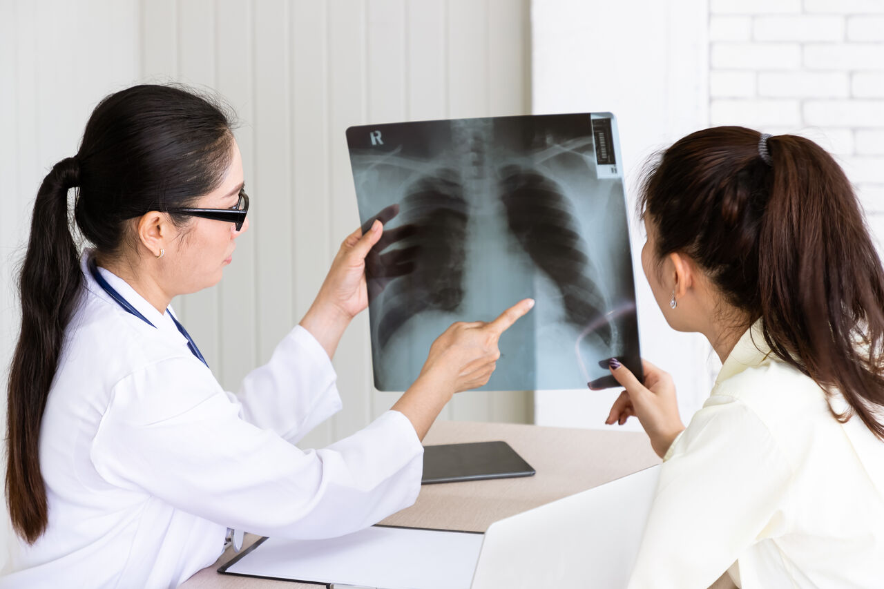Mumbai, Health, Chest X-rays I Fortis Healthcare