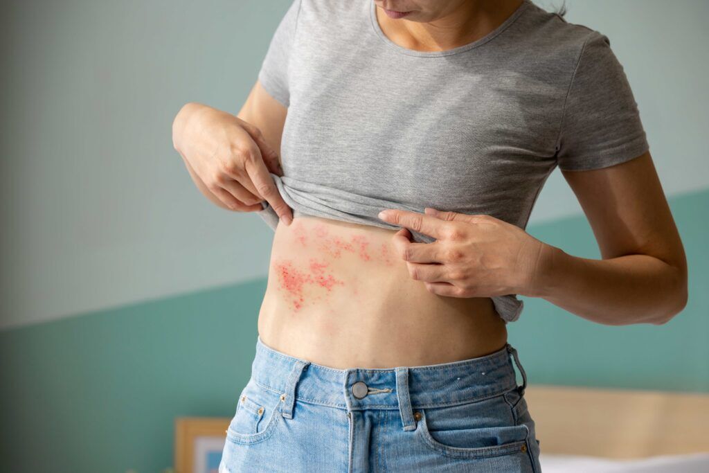 New York, Health, Find Skin Allergy Diagnosis And Treatment Near You In California