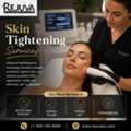 Skin Tightening Services Newport Beach: What To Know
